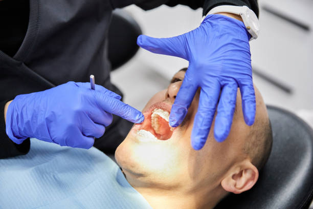 Best Emergency Tooth Extraction in Dillonvale, OH