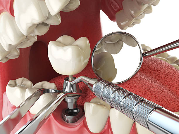 Best Emergency Treatment for Dental Infections or Abscesses in Dillonvale, OH