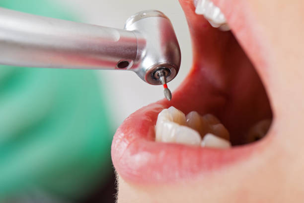 Best Emergency Dental Care for Broken or Chipped Teeth in Dillonvale, OH